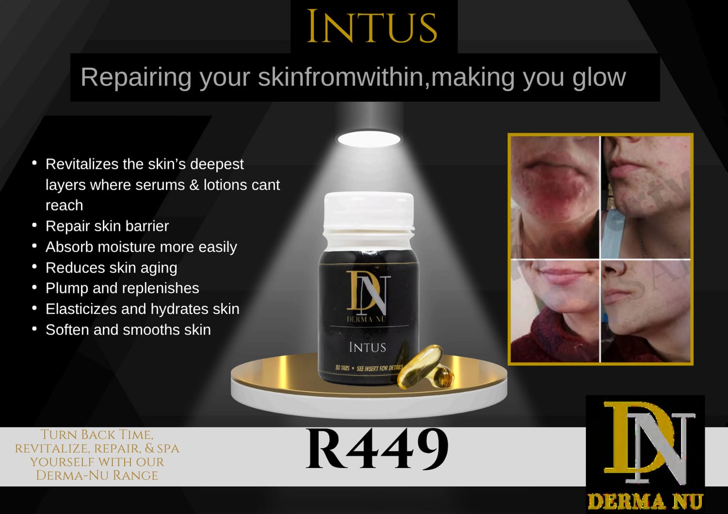 DN 7 Intus